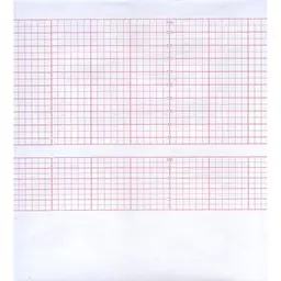 56/1175656